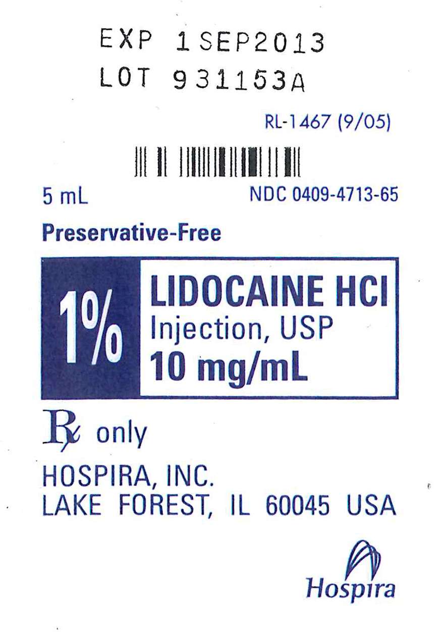 4848-18 CONTINUOUS EPIDURAL 18G TUOHY